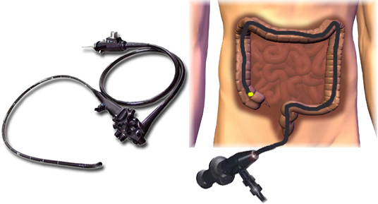 colon3.jpg